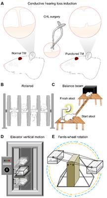 Subtle alterations of vestibulomotor functioning in conductive hearing loss